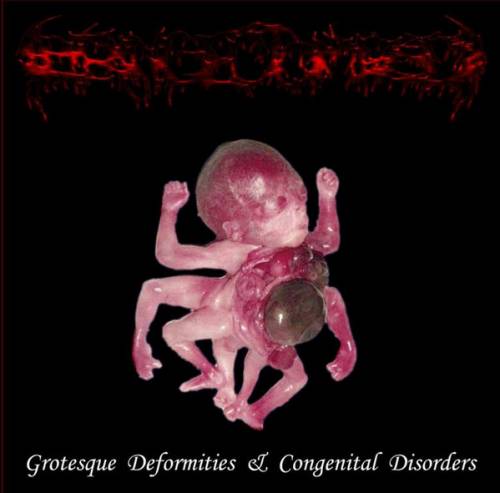 Grotesque Deformities a Congenital Disorders